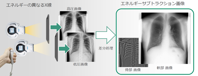 2ショット法エネルギーサブトラクション機能説明図