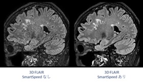 新MRIでの撮像イメージ